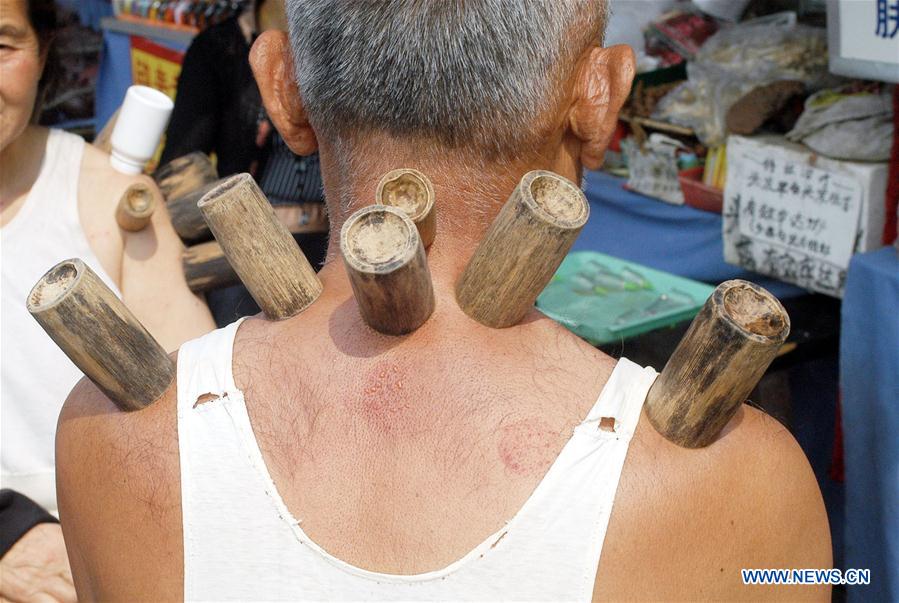 (MOMENTS FOREVER) CHINA-TCM-PRACTICE (CN)