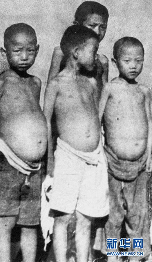 (紅土地“往事新說(shuō)”·圖文互動(dòng))(6)昔日送“瘟神” 今朝健康促小康